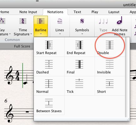 notate in free rhythm 1e