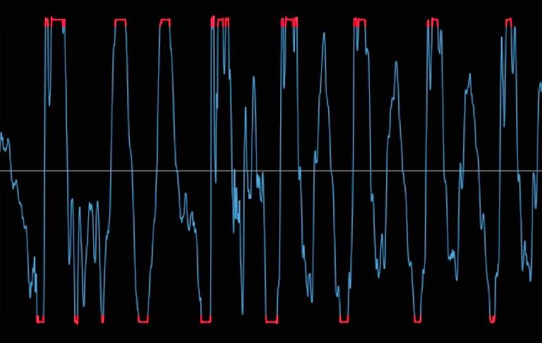 Fig. 4: A distorted vocal wave with digital clipping (the squared-off waveform peaks, in red) from overloading the ADC. 